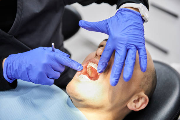 Best Emergency Treatment for Dental Infections or Abscesses in Gunnison, CO